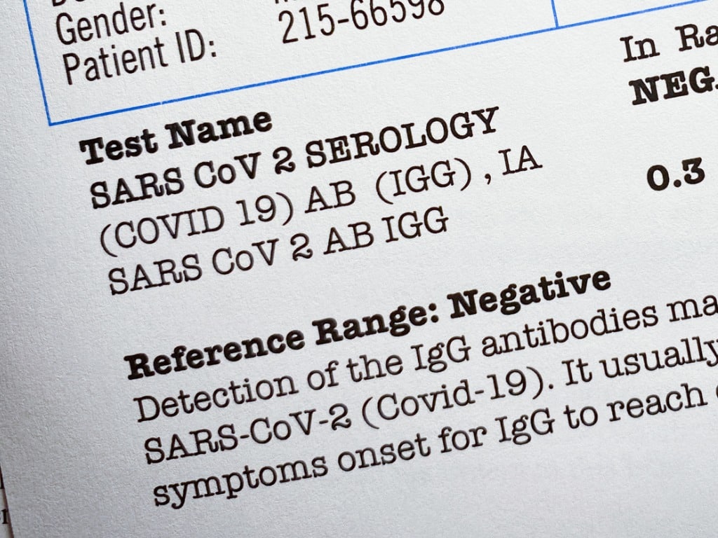 Lab Owner Convicted For Fraudulent COVID-19 Test Results Lab Owner Convicted For Fraudulent COVID-19 Test Results